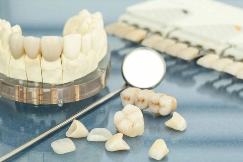 Коронка на жевательный зуб в Москве | Стоматологическая клиника «Лаки Смайл»