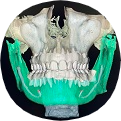 3d сканирование челюсти